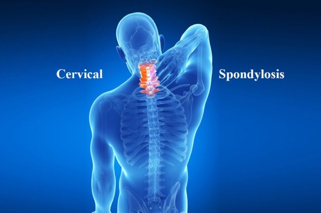 Neck Pain / Cervical Spondylosis