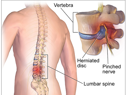 Best Doctor for Spine Surgery in Nagpur