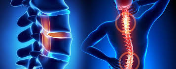 Best Spine Doctor In Jabalpur