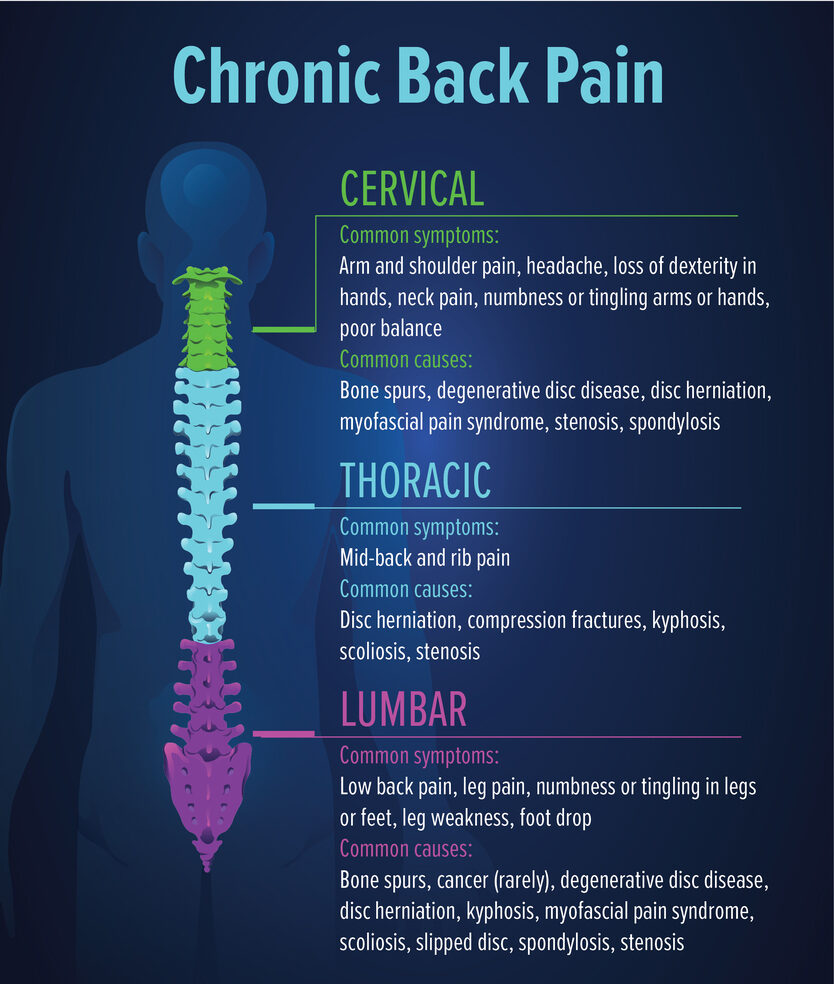 Chronic Back Pain Doctor In Nagpur