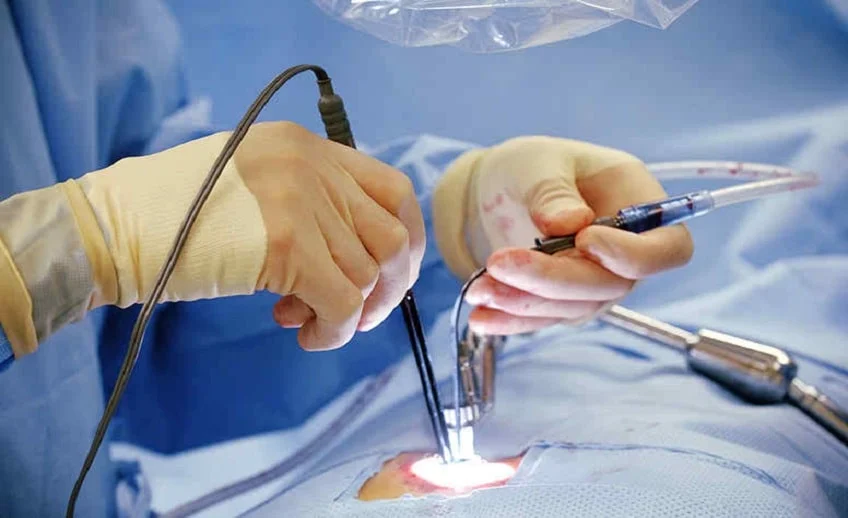 Endoscopic Spine Surgery In Amravati