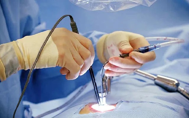 Endoscopic Spine Surgery In Balaghat