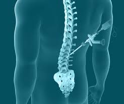 Endoscopic Spine Surgery In Betul