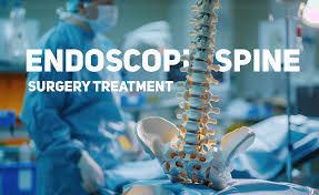 Endoscopic Spine Surgery In Yavatmal
