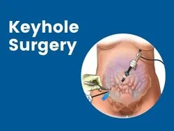 Keyhole Spine Surgery In Ambikapur