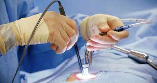 Endoscopic Spine Surgery In Chhattisgarh