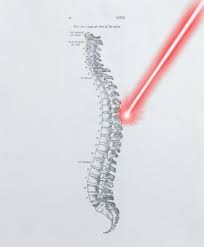 Laser Spine Surgery Doctor In Amravati