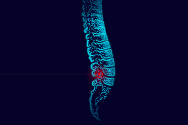 Laser Spine Surgery Doctor In Raipur