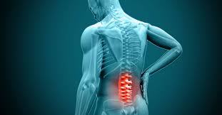 Lumbar Spine Surgery Nagpur