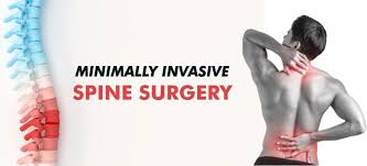 Minimally Invasive Spine Surgery In Raipur