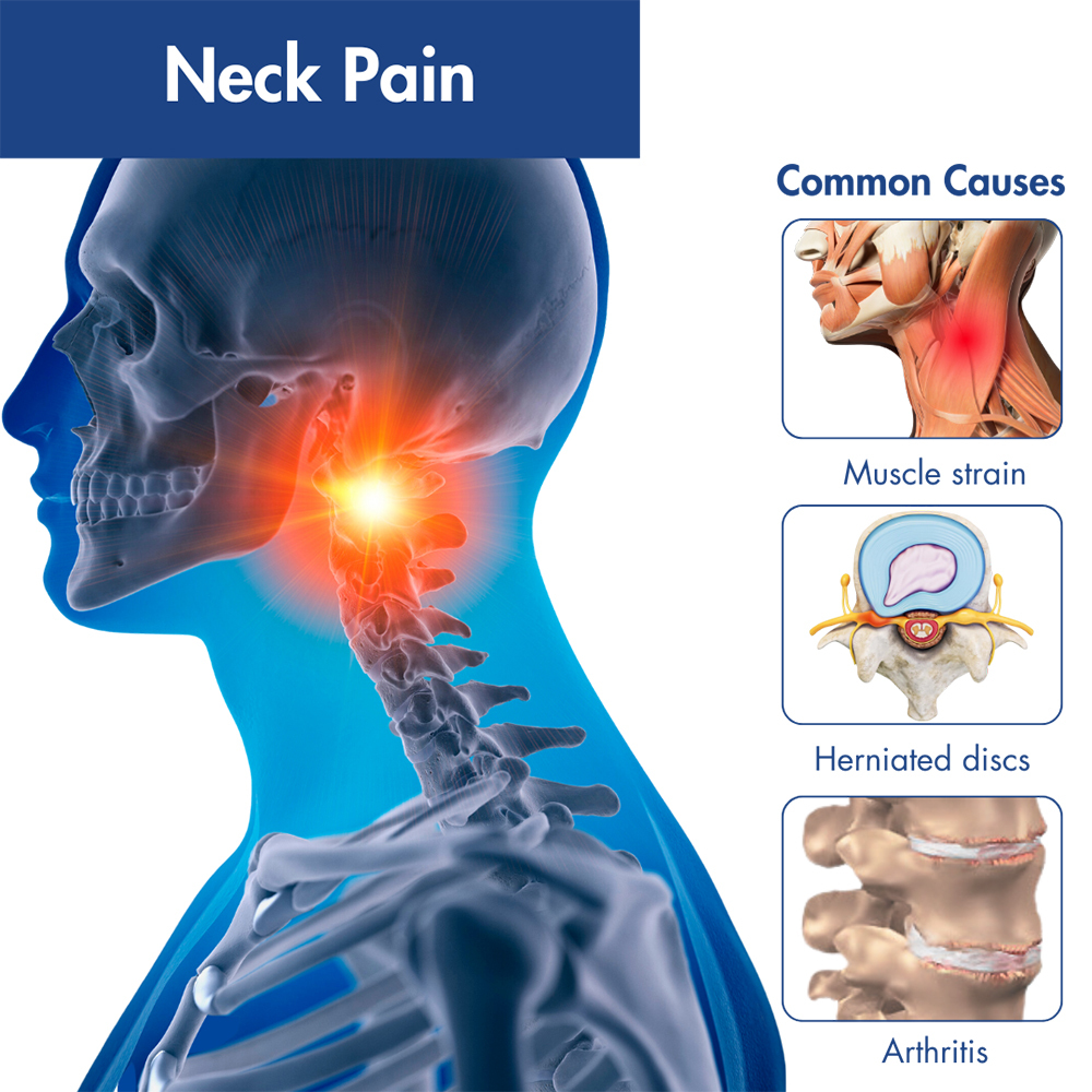 Neck Pain Specialist In Nagpur
