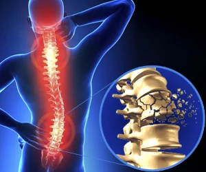 Spine Injury Specialist In Nagpur