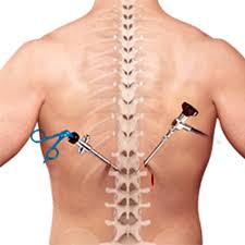 Spine Surgery Doctor In Nagpur