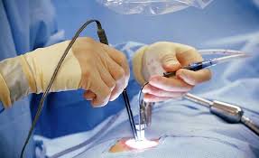 Spine Surgery Endoscopic In Chandrapur