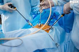 Spine Surgery Endoscopic In Harda