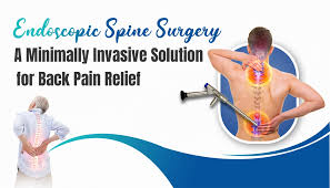 Spine Surgery Endoscopic In Nagpur