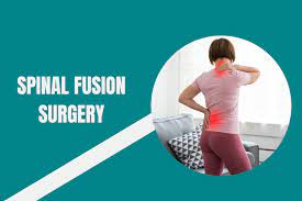 Spine Surgery Fusion In Nagpur