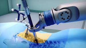 Spine Surgery Robot In Raipur
