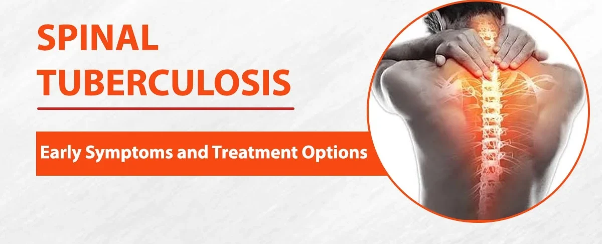 Tuberculosis Of The Spine Treatment In Amravati