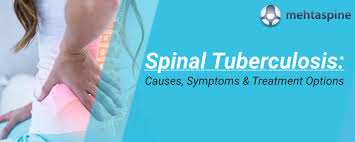 Tuberculosis Of The Spine Treatment In Raipur
