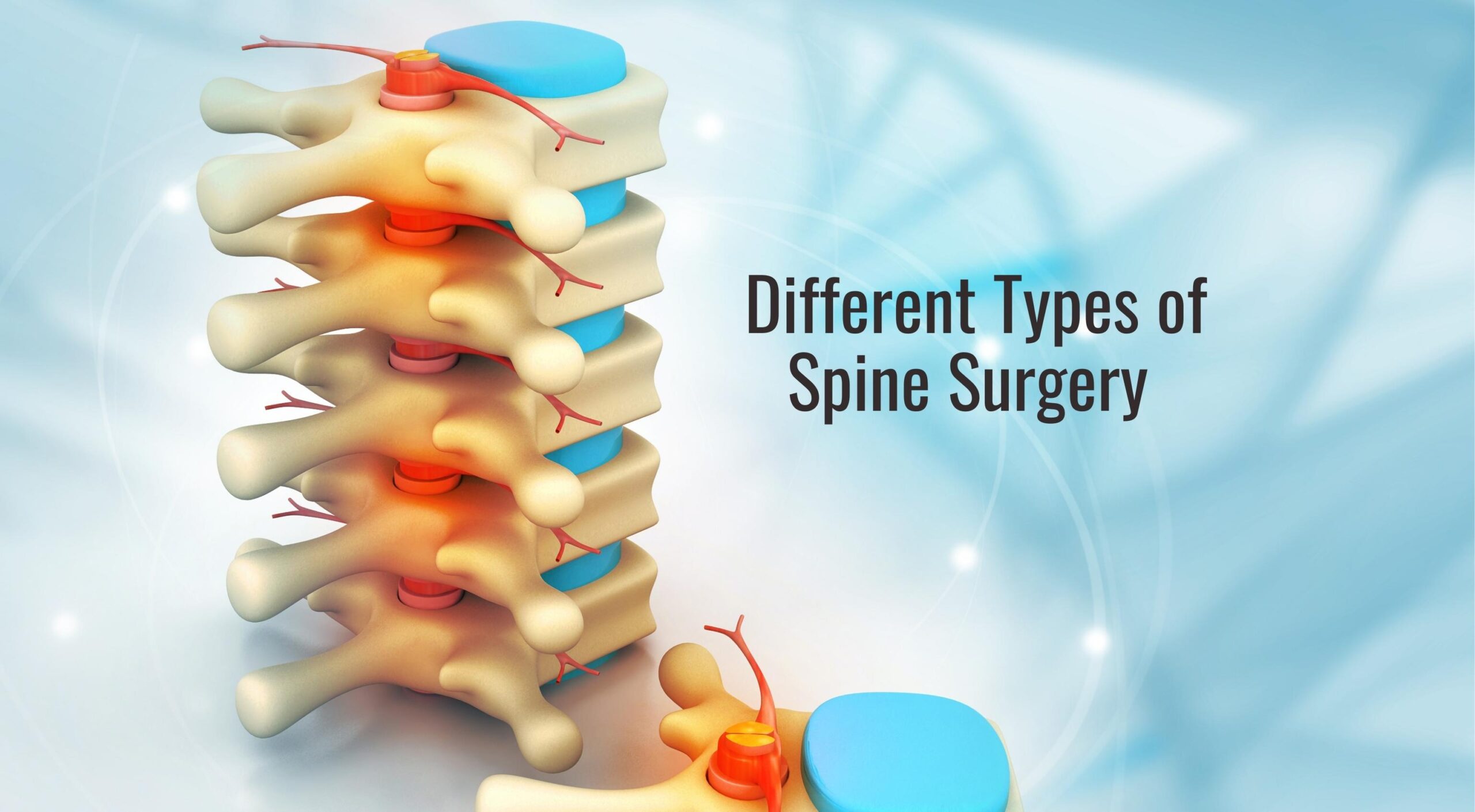 Spine Surgery Types in Nagpur