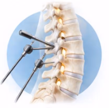 Spine Surgery Lumbar In Nagpur